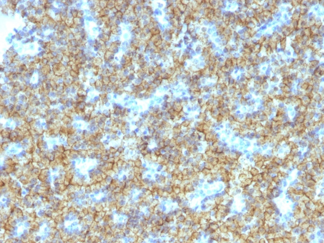 Parathyroid Hormone (PTH) Antibody in Immunohistochemistry (Paraffin) (IHC (P))