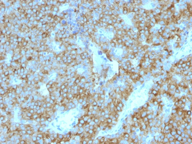 Parathyroid Hormone (PTH) Antibody in Immunohistochemistry (Paraffin) (IHC (P))