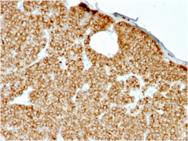 Parathyroid Hormone (PTH) (N-Terminal) Antibody in Immunohistochemistry (Paraffin) (IHC (P))