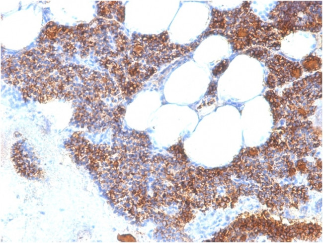 Parathyroid Hormone (PTH) Antibody in Immunohistochemistry (Paraffin) (IHC (P))