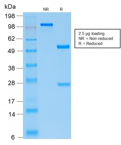 Parathyroid Hormone (PTH) Antibody in SDS-PAGE (SDS-PAGE)