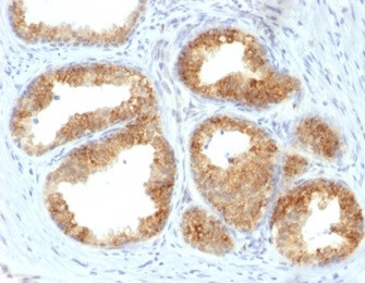 Cycloxygenase-2 (COX-2) Antibody in Immunohistochemistry (Paraffin) (IHC (P))