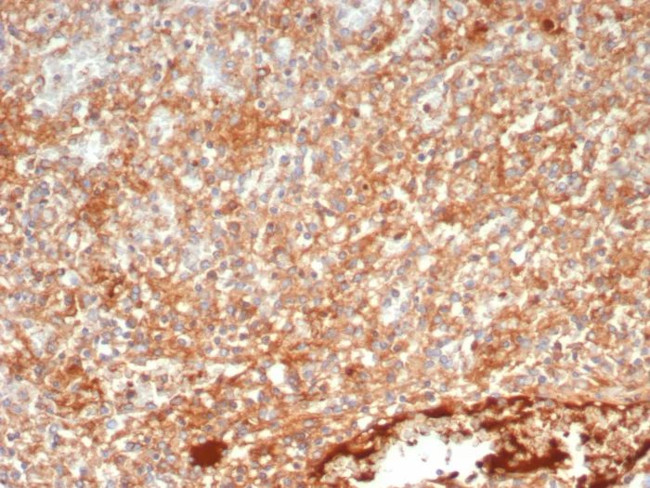 Protein Tyrosine Phosphatase, non-receptor type 6 Antibody in Immunohistochemistry (Paraffin) (IHC (P))