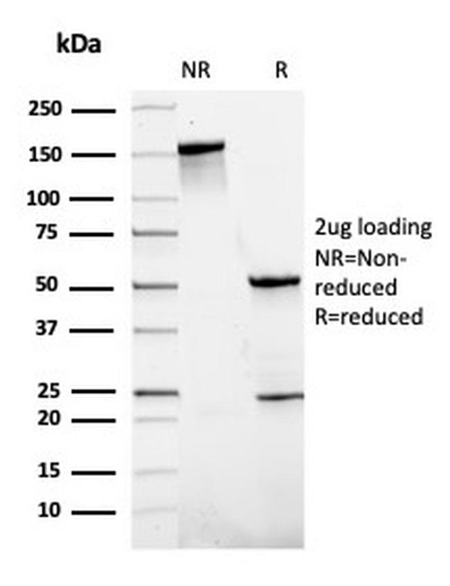 SLAMF7/CS1/CD319 Antibody in SDS-PAGE (SDS-PAGE)