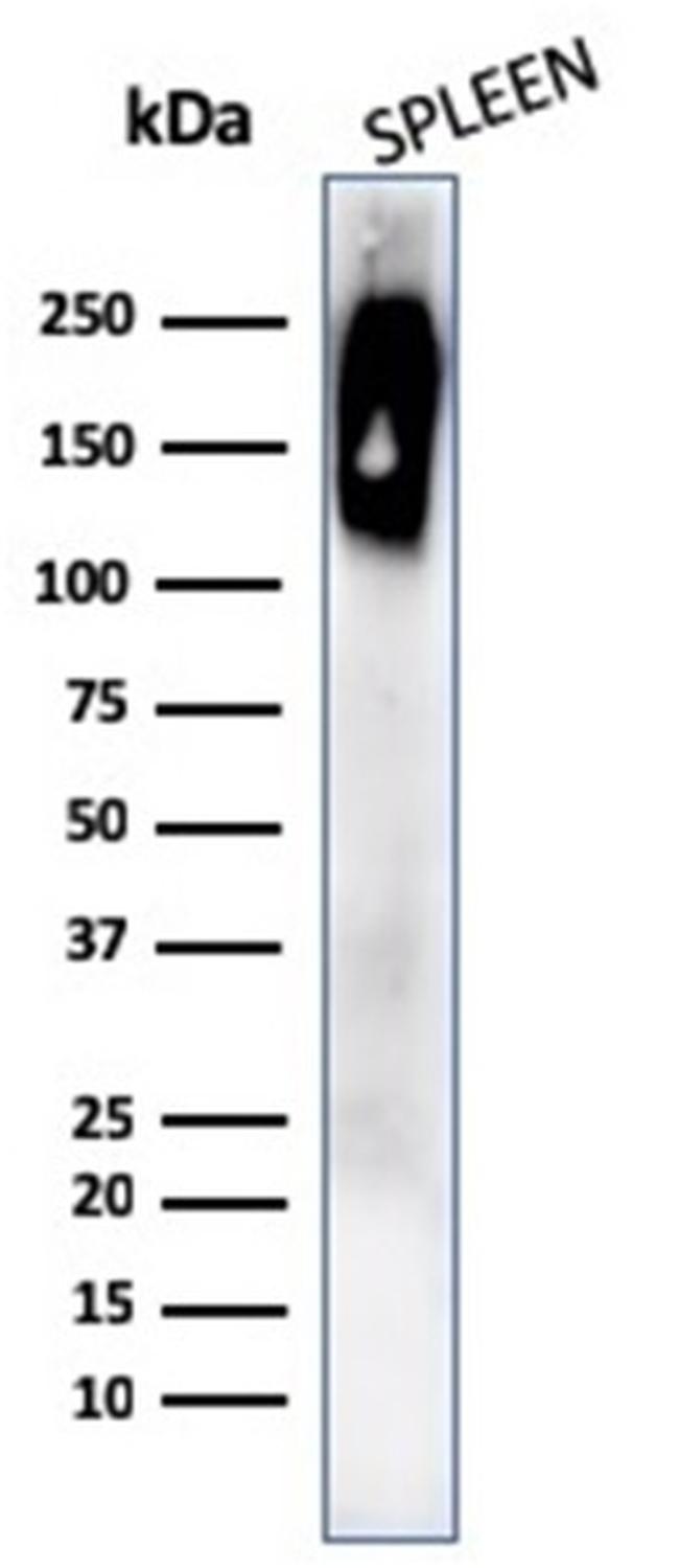 CD45RB Antibody in Western Blot (WB)