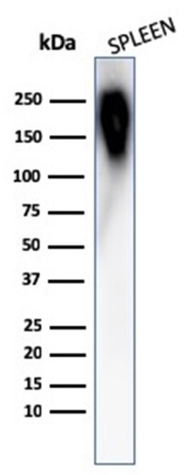 CD45RB Antibody in Western Blot (WB)