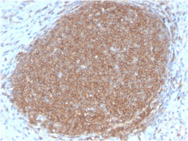 CD45RB Antibody in Immunohistochemistry (Paraffin) (IHC (P))