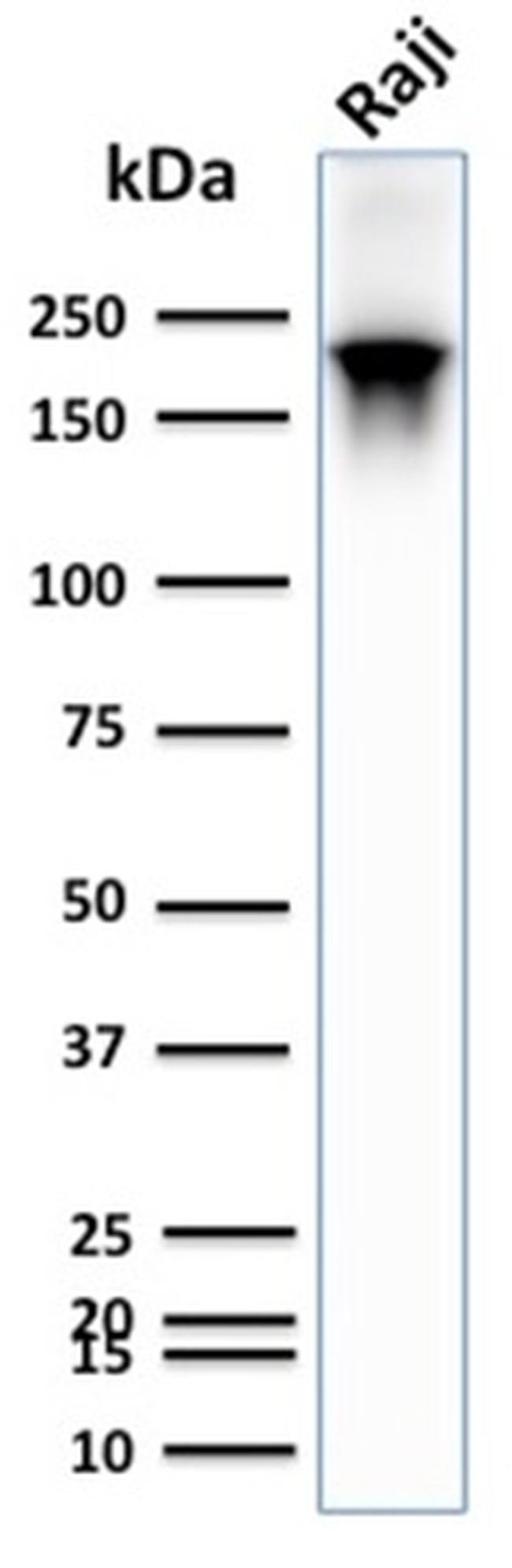 CD45RB Antibody in Western Blot (WB)