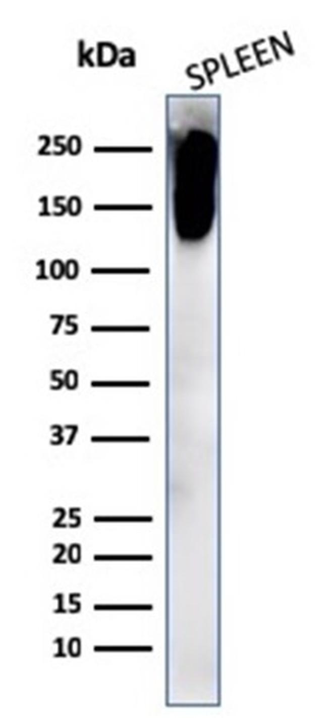 CD45RB Antibody in Western Blot (WB)