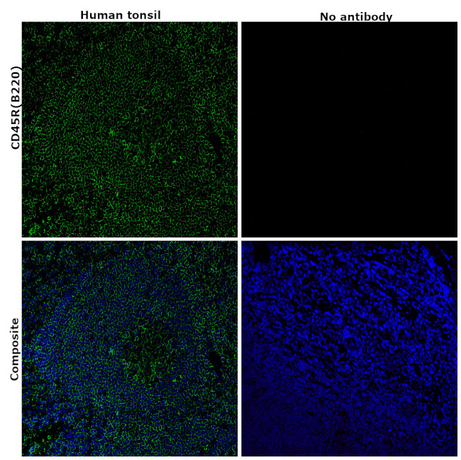 CD45R (B220) Antibody in Immunohistochemistry (Paraffin) (IHC (P))