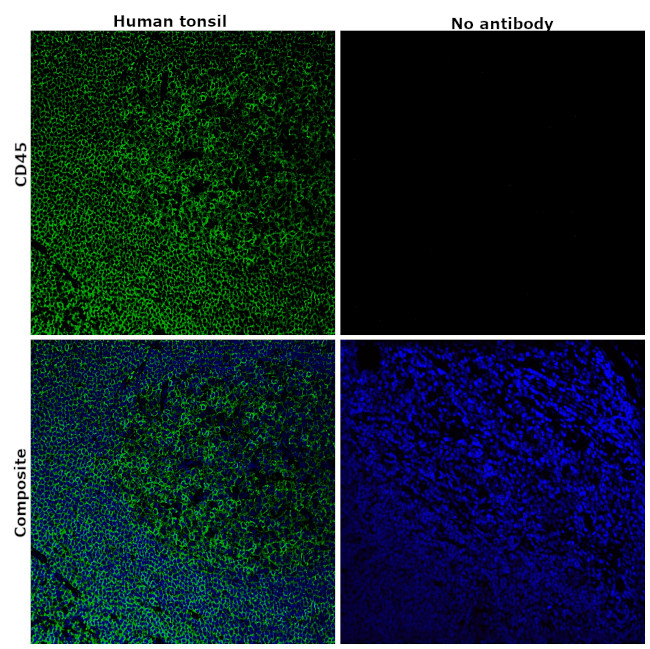 CD45 Antibody in Immunohistochemistry (Paraffin) (IHC (P))