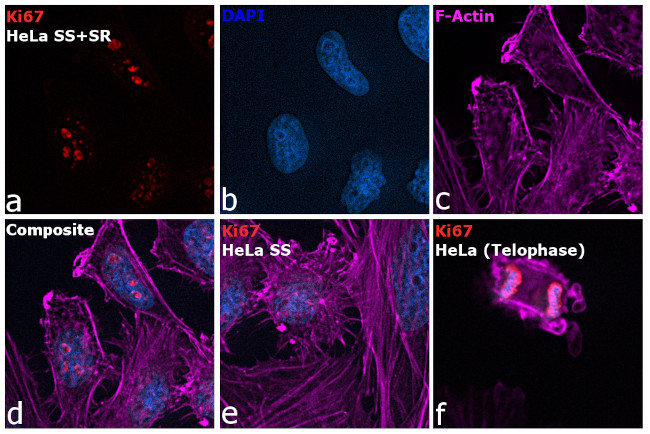 Ki-67 Antibody in Immunocytochemistry (ICC/IF)