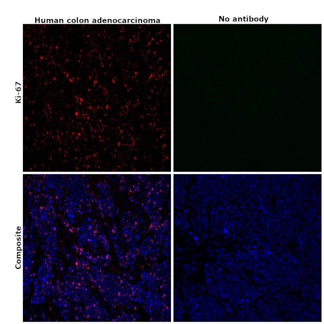 Ki-67 Antibody in Immunohistochemistry (Paraffin) (IHC (P))