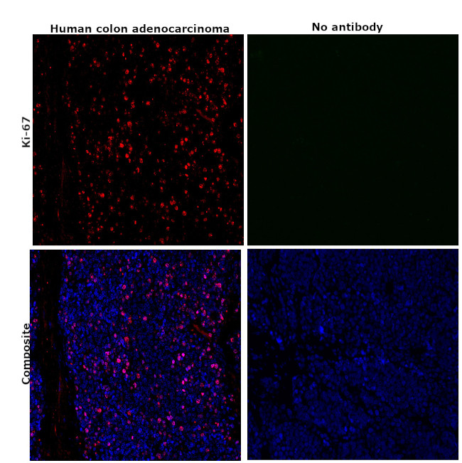 Ki-67 Antibody in Immunohistochemistry (Paraffin) (IHC (P))