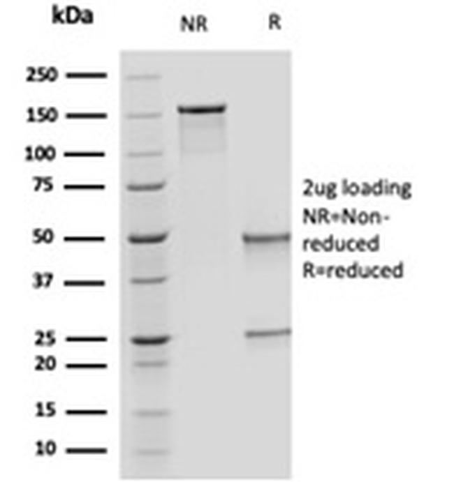 OVOL2/CRE-BPa Antibody in SDS-PAGE (SDS-PAGE)