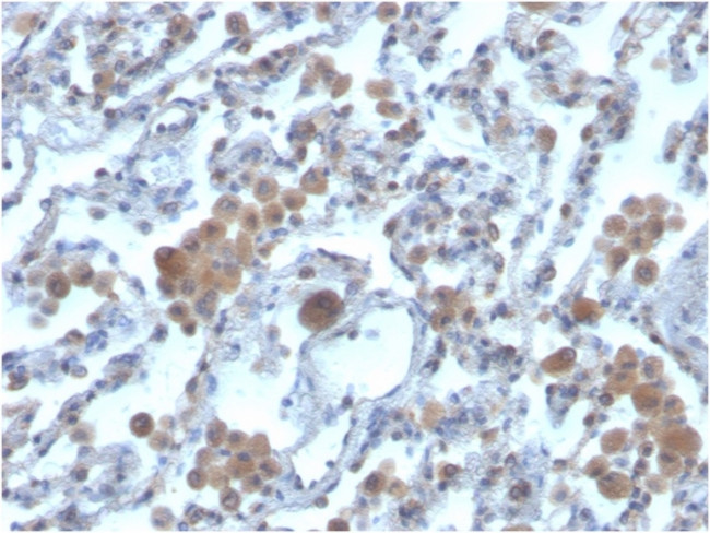 Ras-related C3 botulinum toxin substrate 1 Antibody in Immunohistochemistry (Paraffin) (IHC (P))