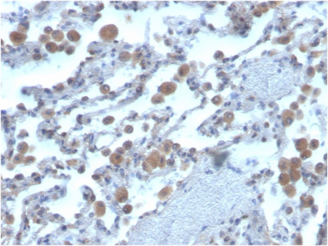 Ras-related C3 botulinum toxin substrate 1 Antibody in Immunohistochemistry (Paraffin) (IHC (P))