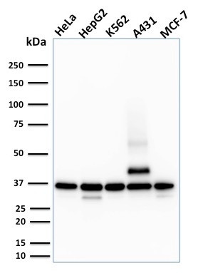 RAD51 (Prognostic and Response to Chemotherapy Marker) Antibody in Western Blot (WB)