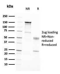 RAD51 (Prognostic and Response to Chemotherapy Marker) Antibody in SDS-PAGE (SDS-PAGE)