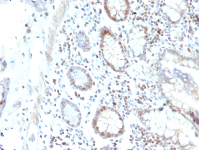 RAD51 Antibody in Immunohistochemistry (Paraffin) (IHC (P))