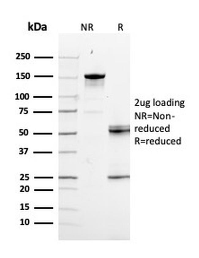 RAD51 Antibody in SDS-PAGE (SDS-PAGE)