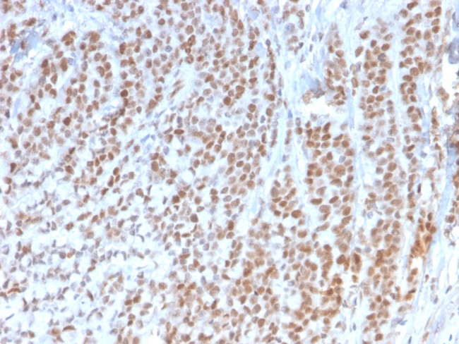 Rb1 (Tumor Suppressor Protein) Antibody in Immunohistochemistry (Paraffin) (IHC (P))