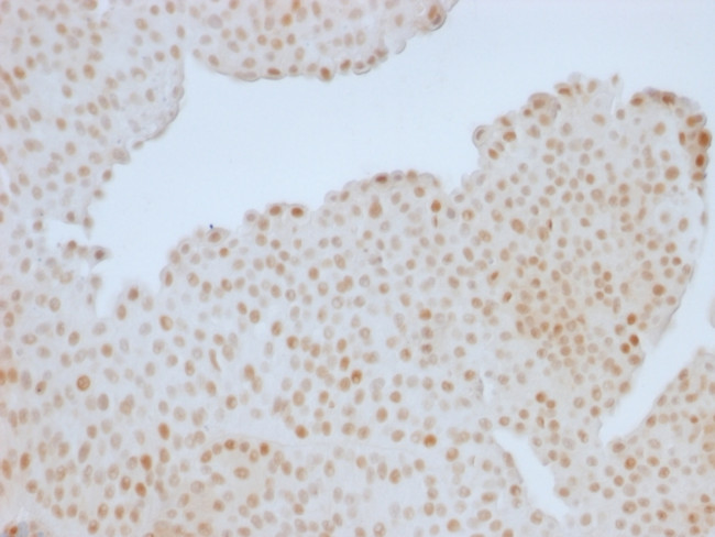 Rb1 (Tumor Suppressor Protein) Antibody in Immunohistochemistry (Paraffin) (IHC (P))