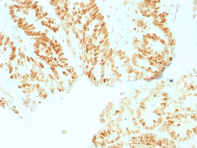 Rb1 (Tumor Suppressor Protein) Antibody in Immunohistochemistry (Paraffin) (IHC (P))