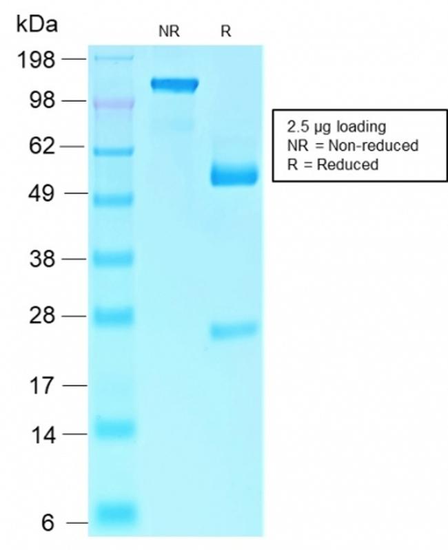 Rb1 (Tumor Suppressor Protein) Antibody in SDS-PAGE (SDS-PAGE)