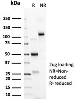 ACE2/Angiotensin I Converting Enzyme 2 Antibody in SDS-PAGE (SDS-PAGE)