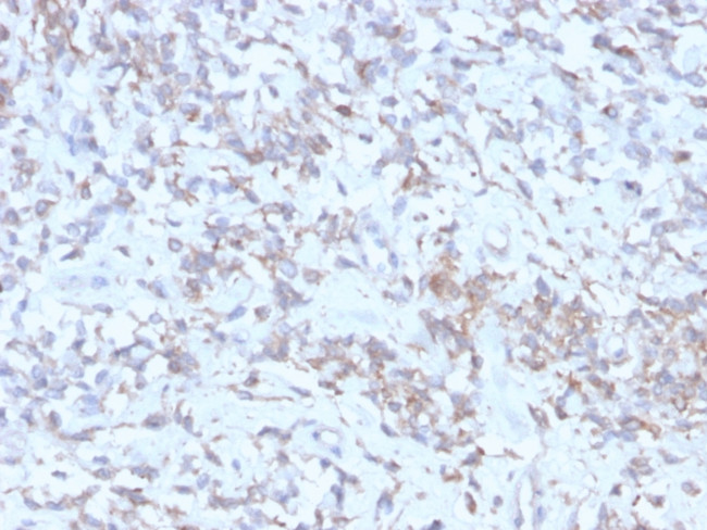 Retinol Binding Protein-1 (RBP1) Antibody in Immunohistochemistry (Paraffin) (IHC (P))