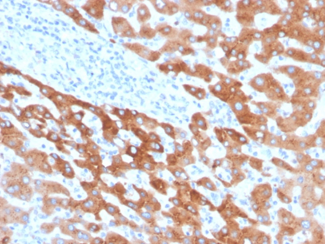 RBP4/Retinol Binding Protein 4 Antibody in Immunohistochemistry (Paraffin) (IHC (P))