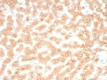 RBP4/Retinol Binding Protein 4 Antibody in Immunohistochemistry (Paraffin) (IHC (P))