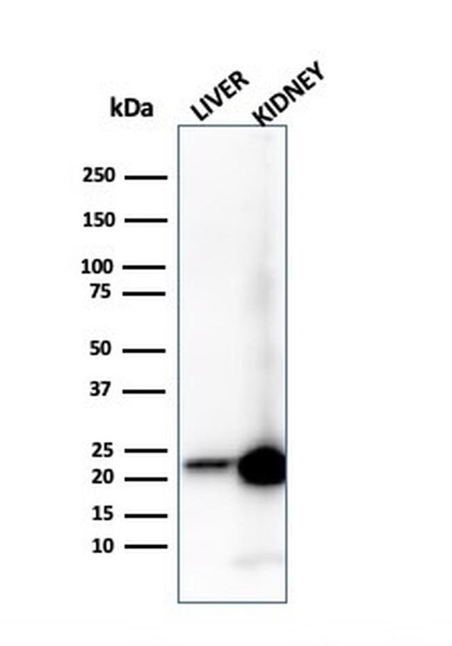 RBP4/Retinol Binding Protein 4 Antibody in Western Blot (WB)