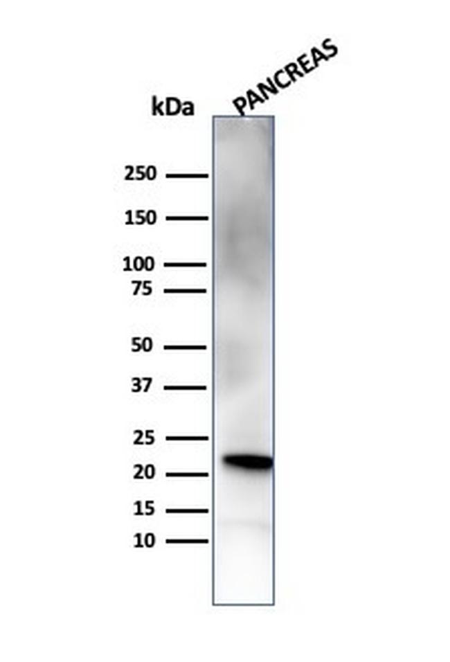 RBP4/Retinol Binding Protein 4 Antibody in Western Blot (WB)