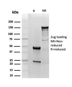 RBP4/Retinol Binding Protein 4 Antibody in SDS-PAGE (SDS-PAGE)