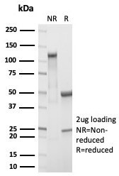 RBP4/Retinol Binding Protein 4 Antibody in SDS-PAGE (SDS-PAGE)