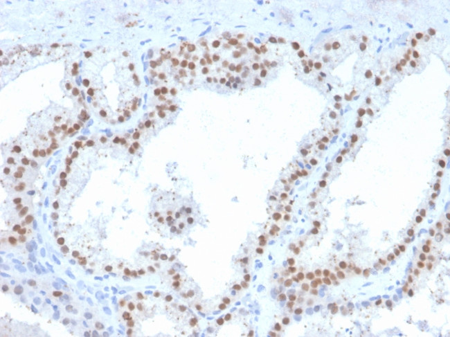 RET Proto-oncogene Antibody in Immunohistochemistry (Paraffin) (IHC (P))