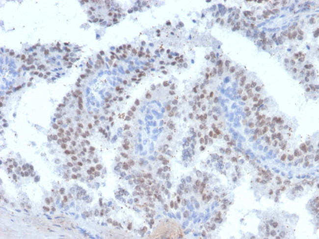 RET Proto-oncogene Antibody in Immunohistochemistry (Paraffin) (IHC (P))