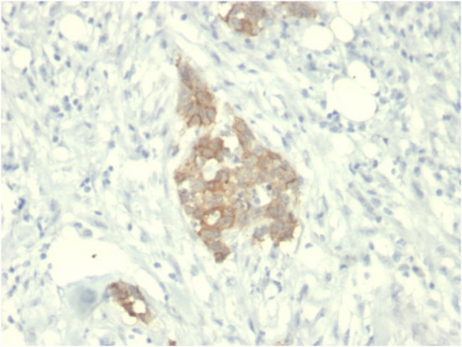 RET Proto-oncogene Antibody in Immunohistochemistry (Paraffin) (IHC (P))