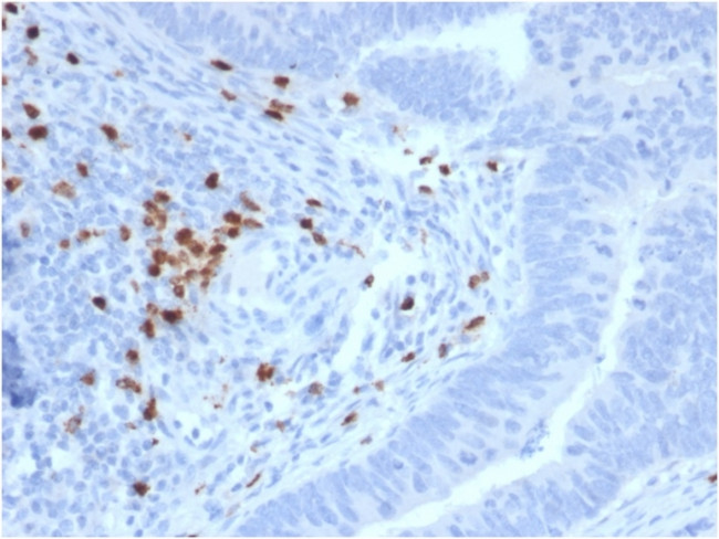 RET Proto-oncogene Antibody in Immunohistochemistry (Paraffin) (IHC (P))