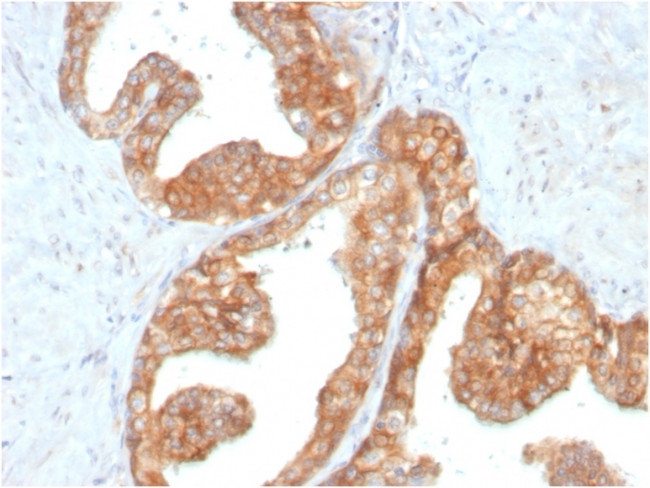 RET Proto-oncogene Antibody in Immunohistochemistry (Paraffin) (IHC (P))