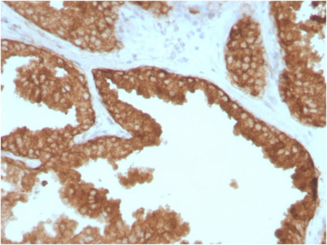 RET Proto-oncogene Antibody in Immunohistochemistry (Paraffin) (IHC (P))