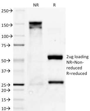 Bcl-X (Apoptosis Marker) Antibody in SDS-PAGE (SDS-PAGE)