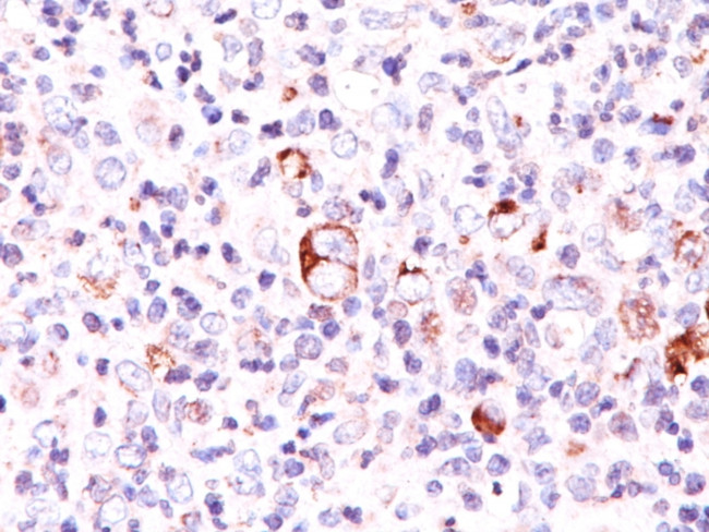 Bcl-X (Apoptosis Marker) Antibody in Immunohistochemistry (Paraffin) (IHC (P))