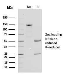 Bcl-X (Apoptosis Marker) Antibody in SDS-PAGE (SDS-PAGE)