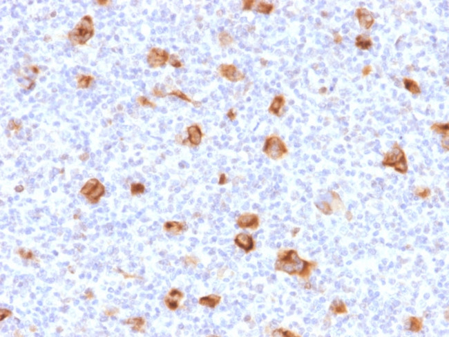 Bcl-X (Apoptosis Marker) Antibody in Immunohistochemistry (Paraffin) (IHC (P))