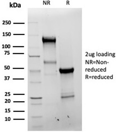 Bcl-X (Apoptosis Marker) Antibody in SDS-PAGE (SDS-PAGE)