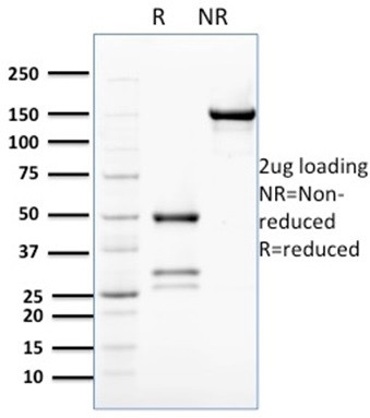 BCL2-like 2 Antibody in SDS-PAGE (SDS-PAGE)