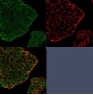 BCL2-like 2 (BCL2L2)/BCL-W Antibody in Immunocytochemistry (ICC/IF)